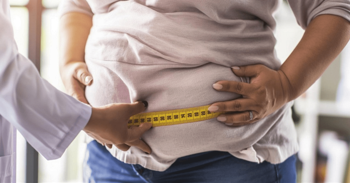 Plano deve cobrir bariátrica de paciente com condição preexistente